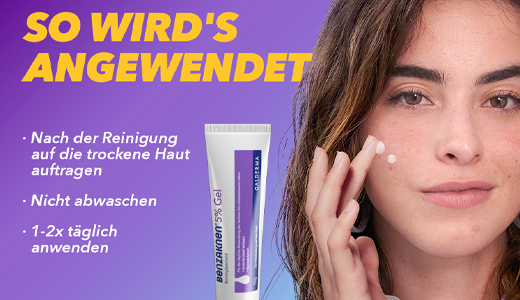 BENZAKNEN Gel al 5%, 15 ml