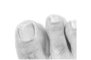 TERBINAFIN-1A Pharma Nagell.g.Nagelpilz 78,22mg/ml, 3,3 ml