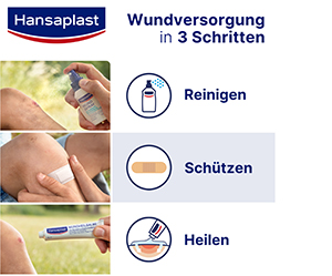 HANSAPLAST Verde & Proteger tiras de yeso, 20 uds