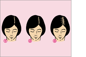 MINOXICUTAN Mujer 20 mg/ml aerosol, 60 ml