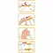 WELLION Safetylancets 28 G esmaltes de seguridad, 25 uds