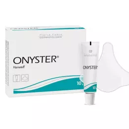ONYSTER Juego de clavos, 1 pieza