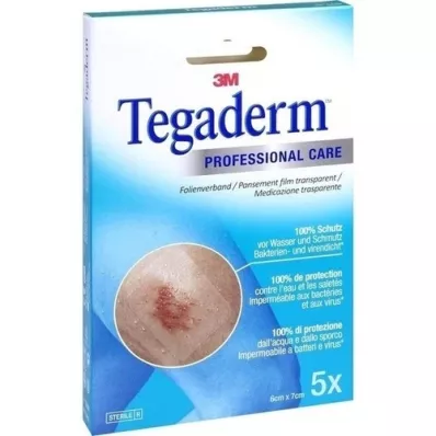 TEGADERM Película 3M 6x7 cm 1624NP, 5 uds