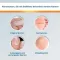 Solución EndWarts® CLASSIC , 3 ml
